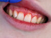 Periodoncia