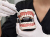 Prótesis Dentales