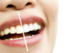 Blanqueamiento dental profesional: beneficios, cuidados y resultados reales