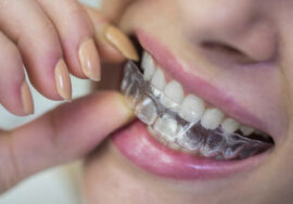 Ortodoncia invisible: la opción moderna para alinear tus dientes sin molestias