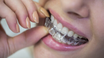Ortodoncia invisible: la opción moderna para alinear tus dientes sin molestias